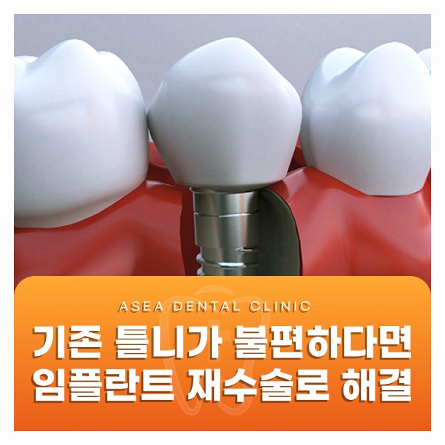 경주 틀니 임플란트, 기존 틀니가 불편할 때 임플란트 재수술로 해결